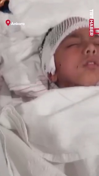 Ankara'da Okuldan Dönen 8 Yaşındaki Çocuğa Köpek Saldırısı: Tedavi Sürüyor