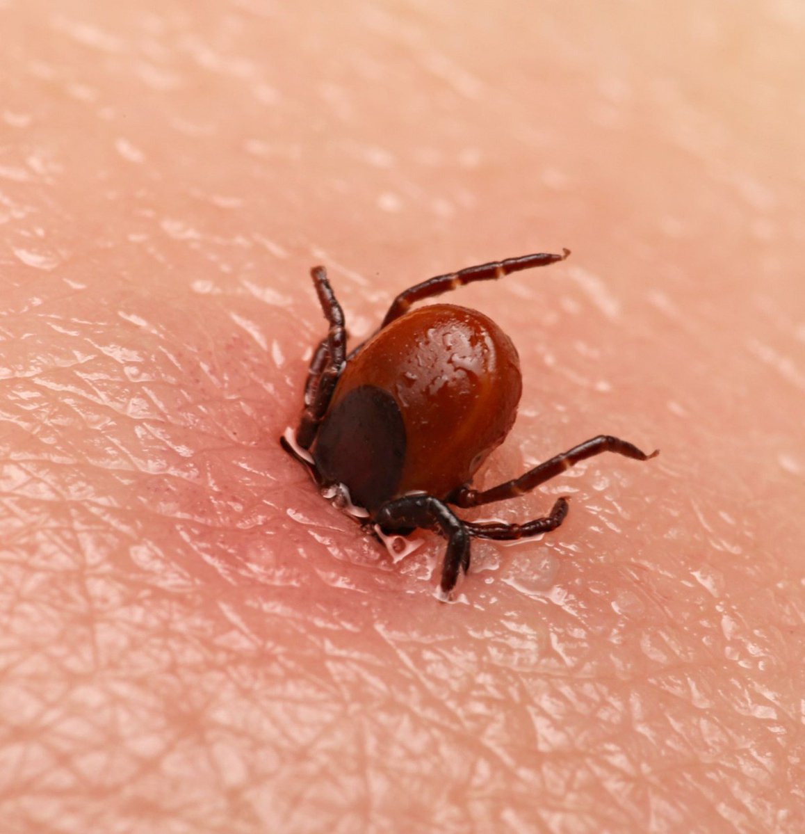 Sivas'ta Kene Isırması Nedeniyle Hayatını Kaybedenlerin Sayısı 12'ye Yükseldi