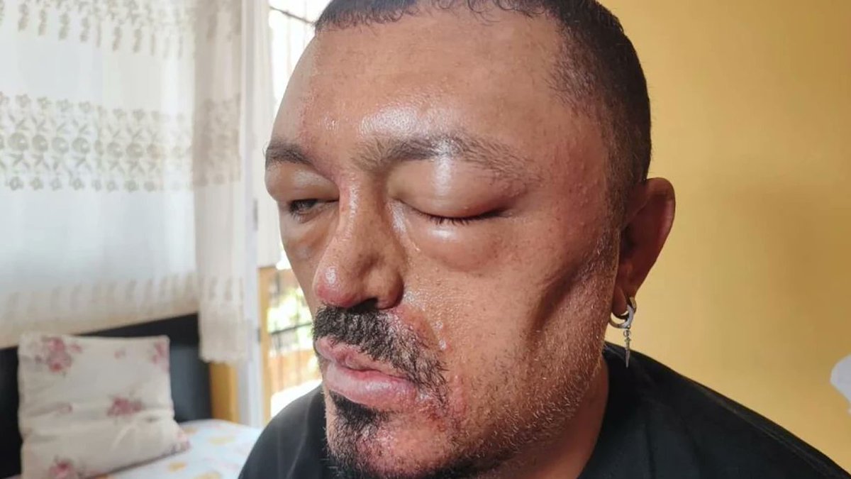 Adana'da Berber Tavsiyesiyle Saç Siyahlaştırıcı Şampuan Deneyimi: Vatandaşın Dönüşümü